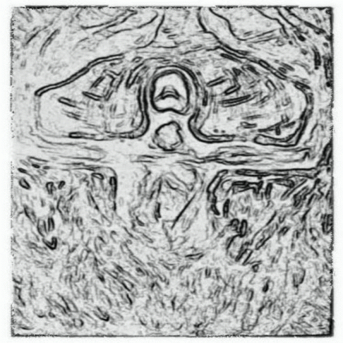 Stagnant and Deteriorating